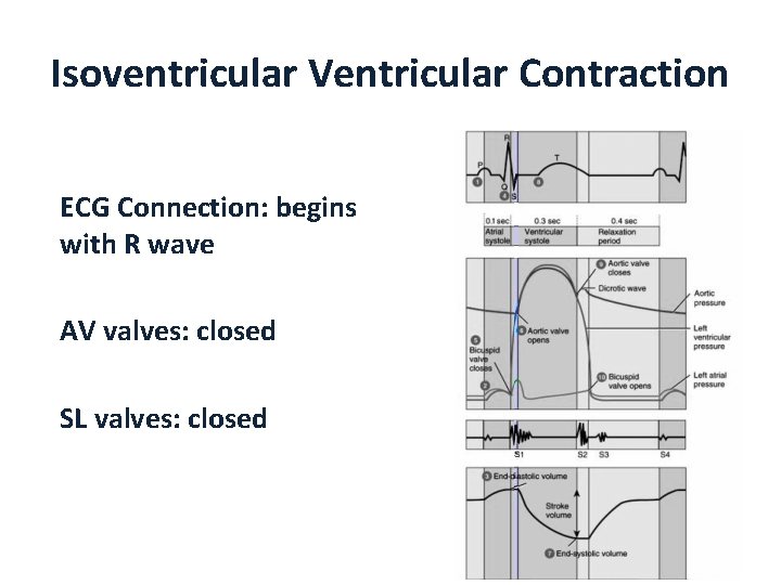 Isoventricular Ventricular Contraction ECG Connection: begins with R wave AV valves: closed SL valves:
