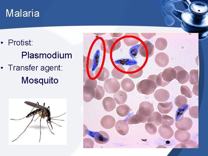 Malaria • Protist: Plasmodium • Transfer agent: Mosquito 