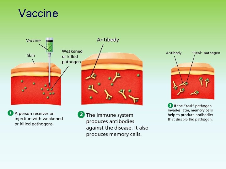 Vaccine 