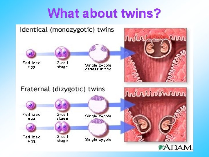 What about twins? 