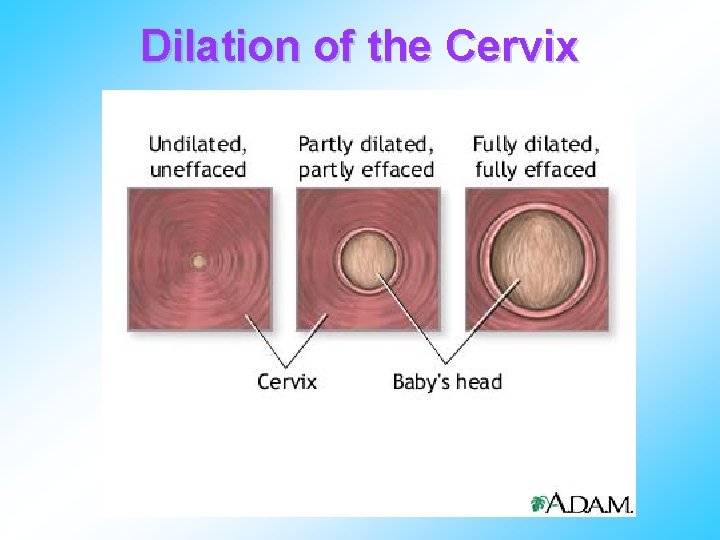 Dilation of the Cervix 