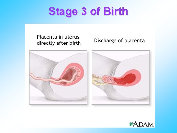Stage 3 of Birth 