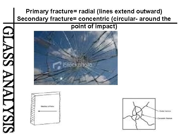 Primary fracture= radial (lines extend outward) Secondary fracture= concentric (circular- around the point of