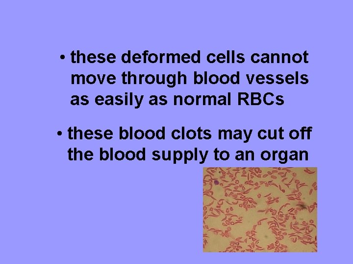  • these deformed cells cannot move through blood vessels as easily as normal