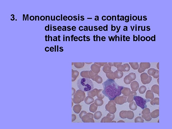 3. Mononucleosis – a contagious disease caused by a virus that infects the white