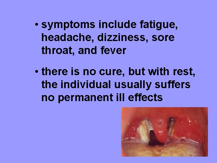  • symptoms include fatigue, headache, dizziness, sore throat, and fever • there is