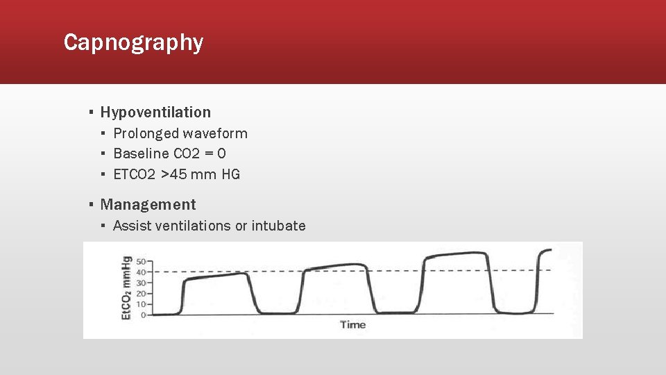 Capnography ▪ Hypoventilation ▪ Prolonged waveform ▪ Baseline CO 2 = 0 ▪ ETCO