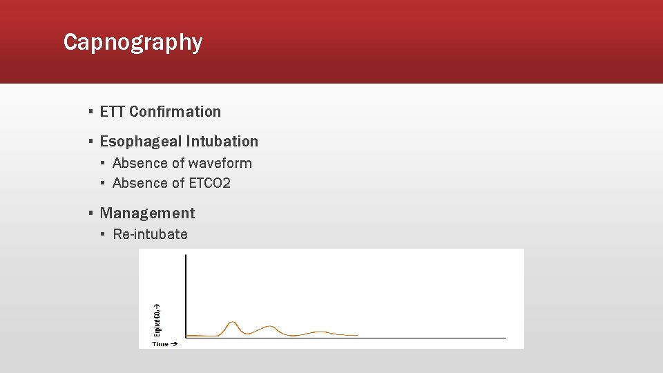 Capnography ▪ ETT Confirmation ▪ Esophageal Intubation ▪ Absence of waveform ▪ Absence of