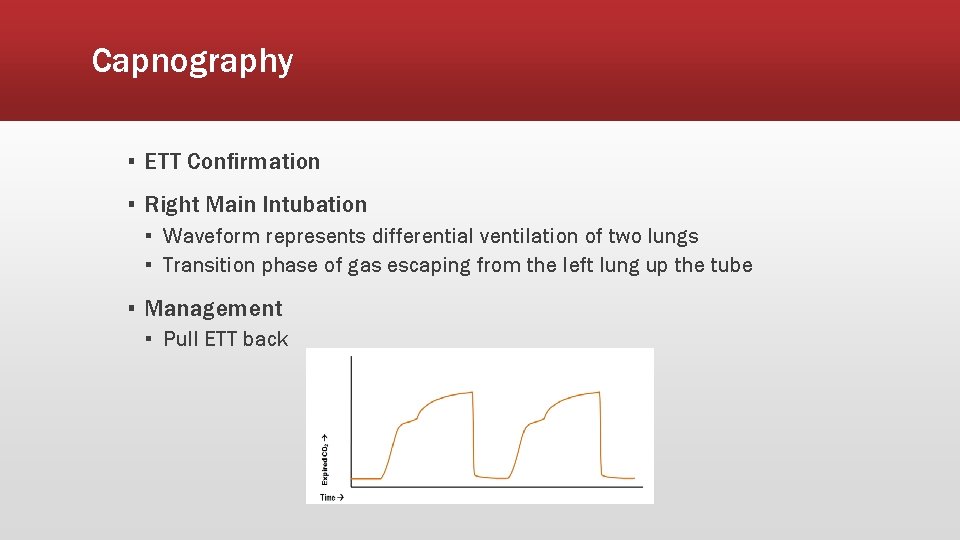 Capnography ▪ ETT Confirmation ▪ Right Main Intubation ▪ Waveform represents differential ventilation of