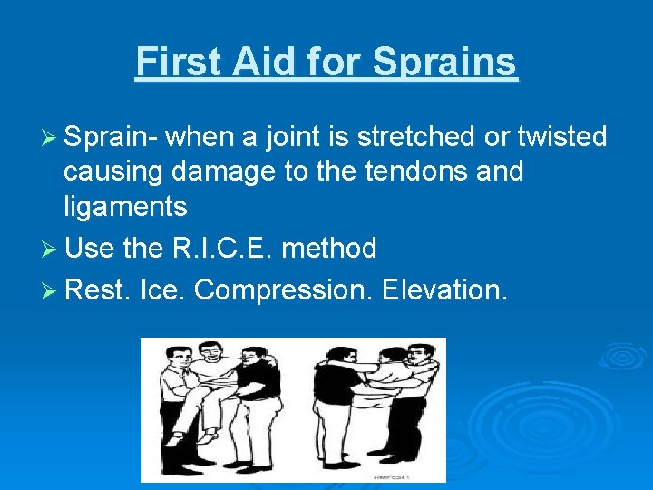 First Aid for Sprains Ø Sprain- when a joint is stretched or twisted causing