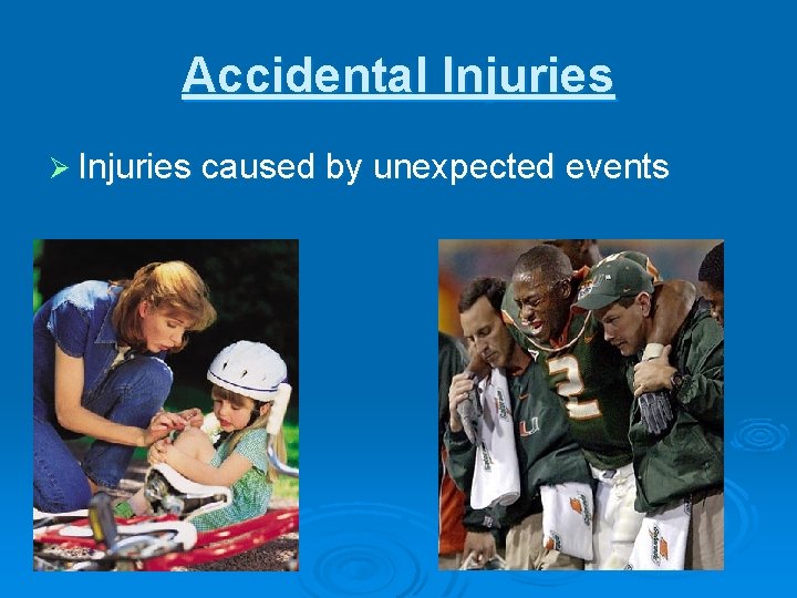 Accidental Injuries Ø Injuries caused by unexpected events 