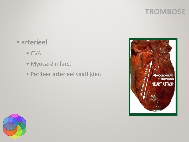 TROMBOSE • arterieel • CVA • Myocard infarct • Perifeer arterieel vaatlijden 
