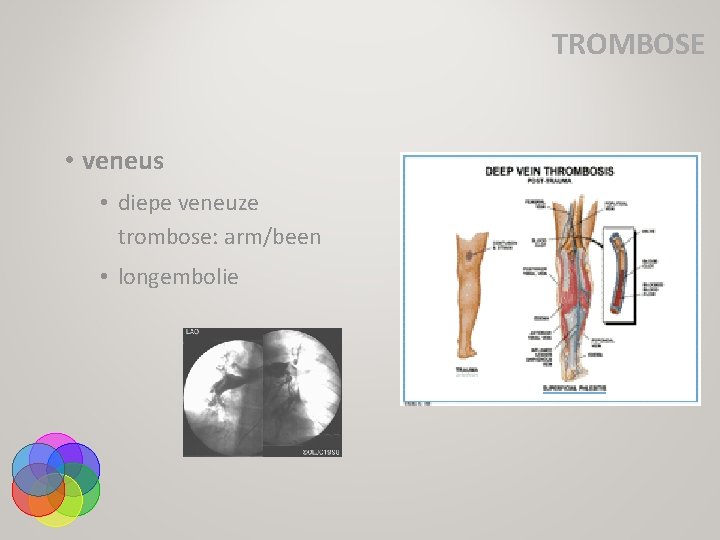 TROMBOSE • veneus • diepe veneuze trombose: arm/been • longembolie 