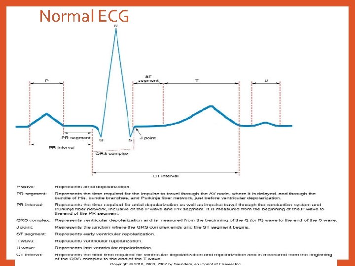 Normal ECG 