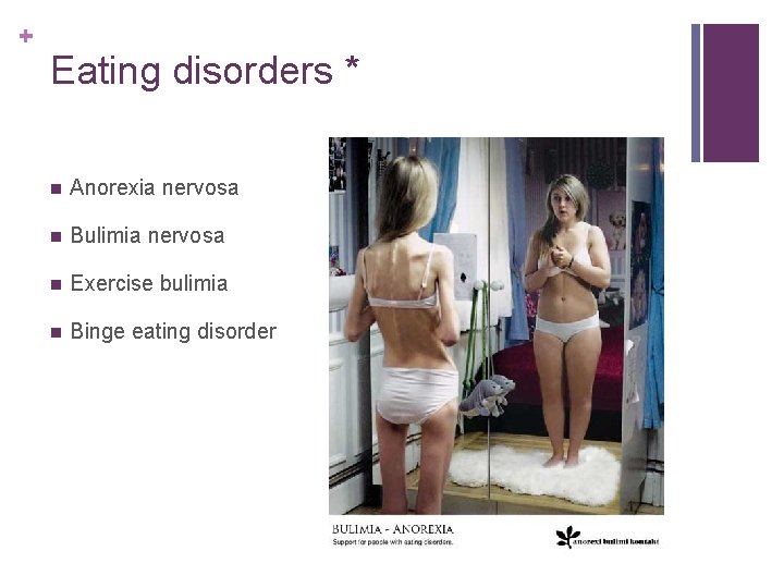 + Eating disorders * n Anorexia nervosa n Bulimia nervosa n Exercise bulimia n