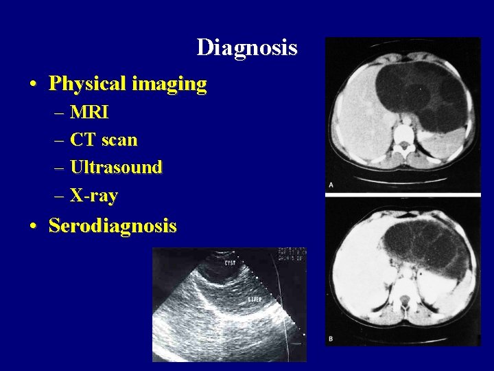 Diagnosis • Physical imaging – MRI – CT scan – Ultrasound – X-ray • Diagnosis • Physical imaging – MRI – CT scan – Ultrasound – X-ray •