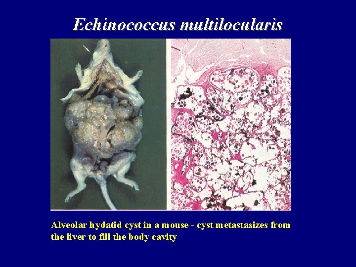 Echinococcus multilocularis Alveolar hydatid cyst in a mouse - cyst metastasizes from the liver Echinococcus multilocularis Alveolar hydatid cyst in a mouse - cyst metastasizes from the liver