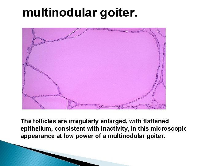 PRACTICAL 6 PATHOLOGY Thyroid gland disorders Macroscopic normal