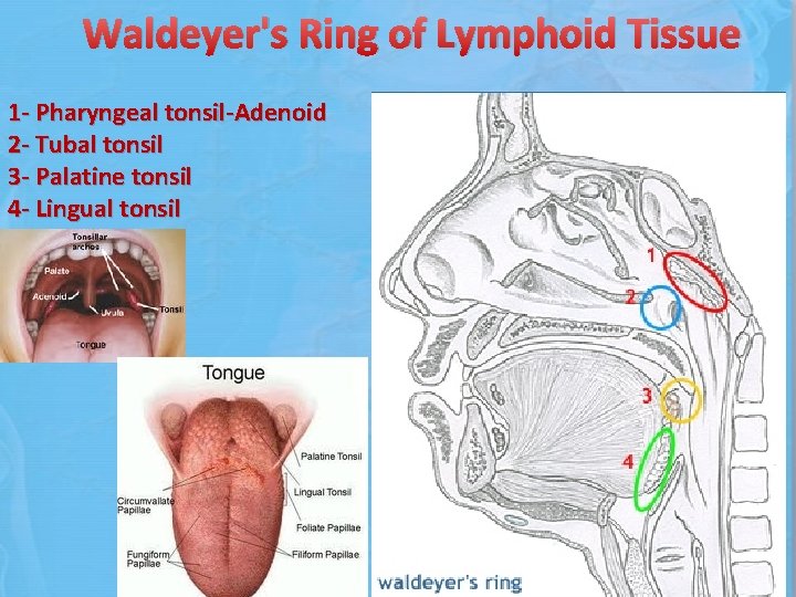 Waldeyer's Ring of Lymphoid Tissue 1 - Pharyngeal tonsil-Adenoid 2 - Tubal tonsil 3