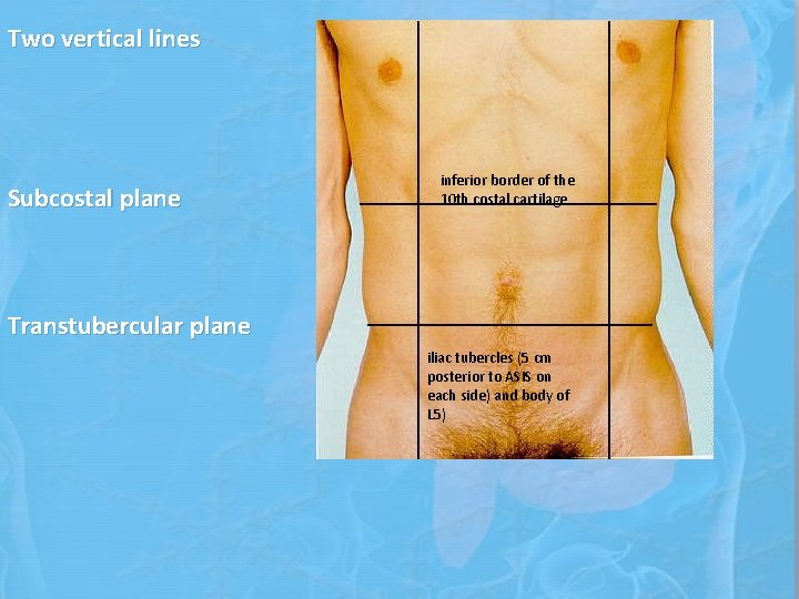 Two vertical lines Subcostal plane inferior border of the 10 th costal cartilage Transtubercular