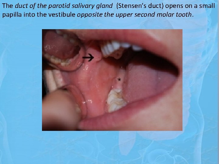 The duct of the parotid salivary gland (Stensen’s duct) opens on a small papilla