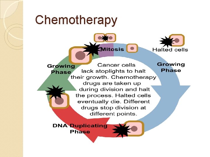 Chemotherapy 