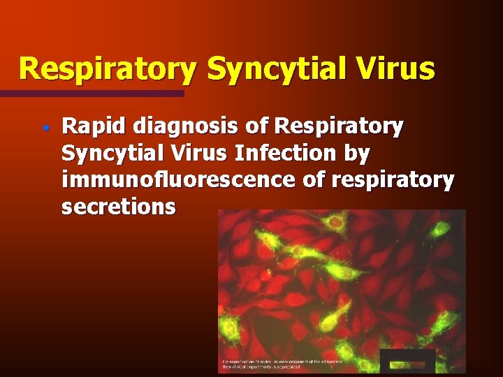 Respiratory Syncytial Virus • Rapid diagnosis of Respiratory Syncytial Virus Infection by immunofluorescence of