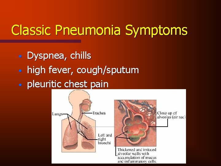 Classic Pneumonia Symptoms • • • Dyspnea, chills high fever, cough/sputum pleuritic chest pain