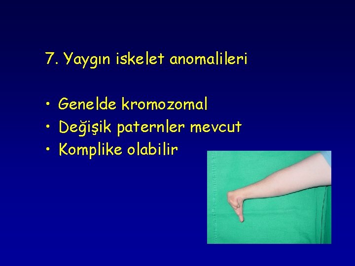 7. Yaygın iskelet anomalileri • Genelde kromozomal • Değişik paternler mevcut • Komplike olabilir