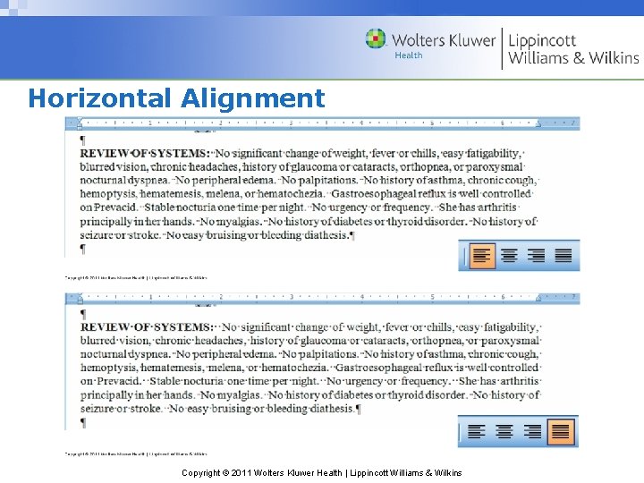 Horizontal Alignment Copyright © 2011 Wolters Kluwer Health | Lippincott Williams & Wilkins 