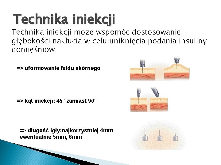 Technika iniekcji może wspomóc dostosowanie głębokości nakłucia w celu uniknięcia podania insuliny domięśniow: =>