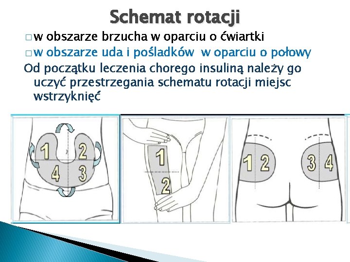 �w Schemat rotacji obszarze brzucha w oparciu o ćwiartki � w obszarze uda i