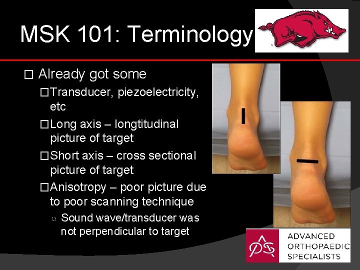 MSK 101: Terminology � Already got some �Transducer, piezoelectricity, etc �Long axis – longtitudinal