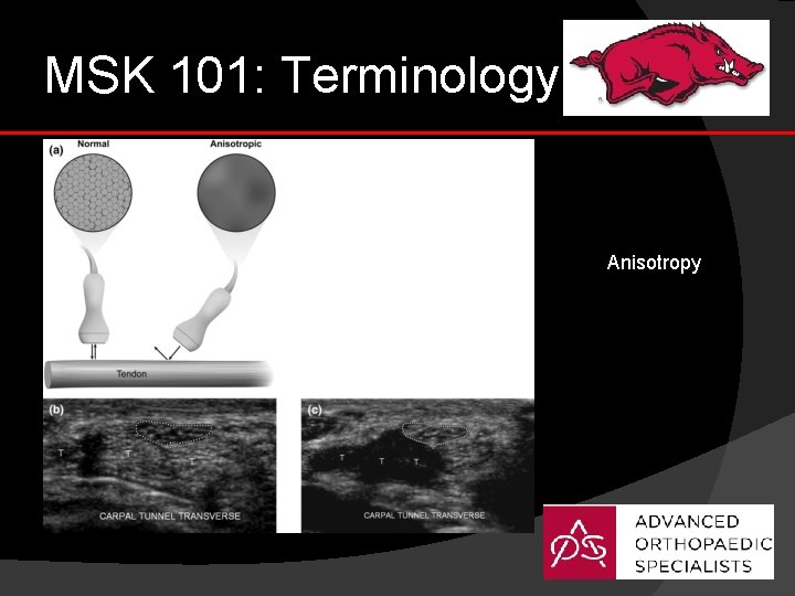 MSK 101: Terminology Anisotropy 