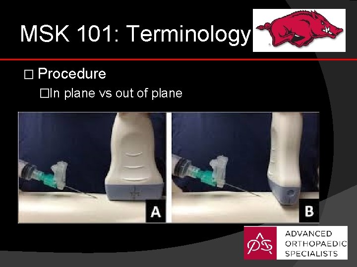 MSK 101: Terminology � Procedure �In plane vs out of plane 