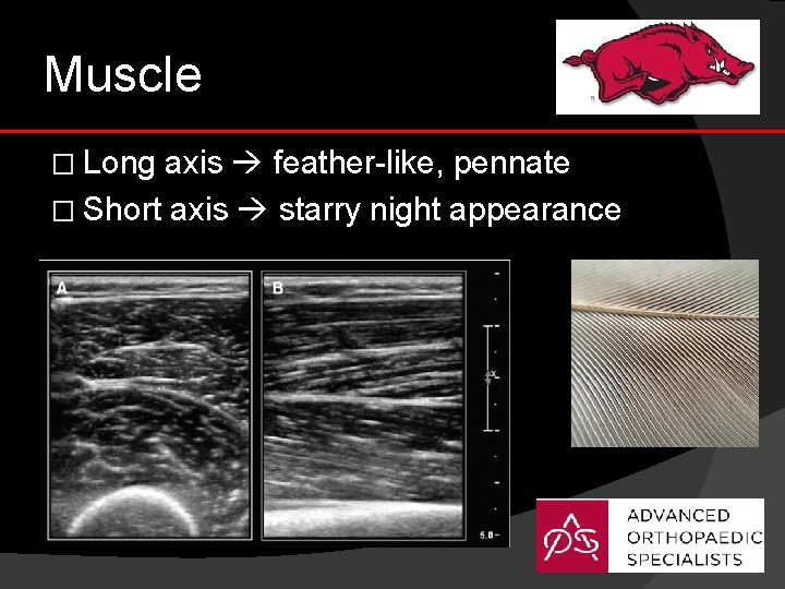 Muscle � Long axis feather-like, pennate � Short axis starry night appearance 