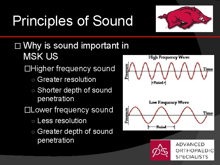 Principles of Sound � Why is sound important in MSK US �Higher frequency sound