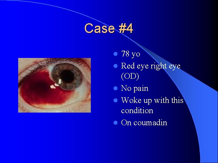 Case #4 l l l 78 yo Red eye right eye (OD) No pain