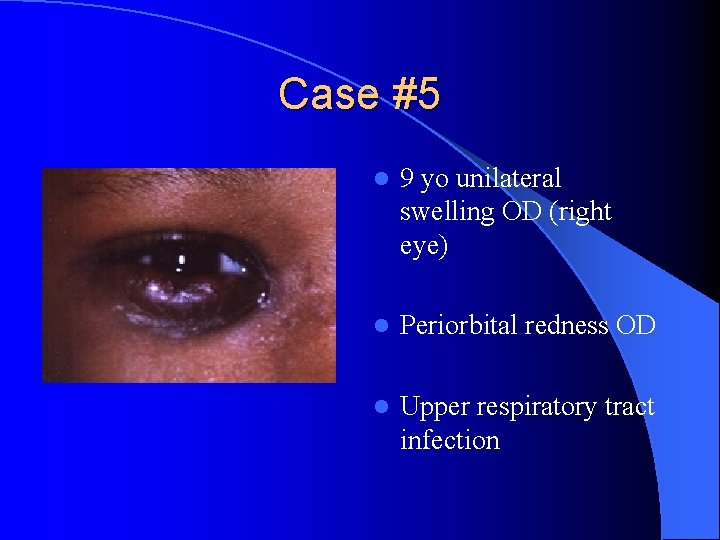 Case #5 l 9 yo unilateral swelling OD (right eye) l Periorbital redness OD