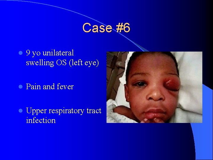 Case #6 l 9 yo unilateral swelling OS (left eye) l Pain and fever