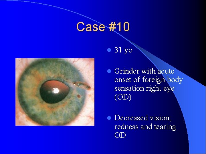 Case #10 l 31 yo l Grinder with acute onset of foreign body sensation