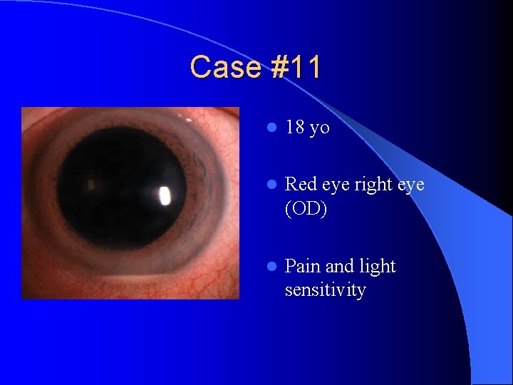 Case #11 l 18 yo l Red eye right eye (OD) l Pain and