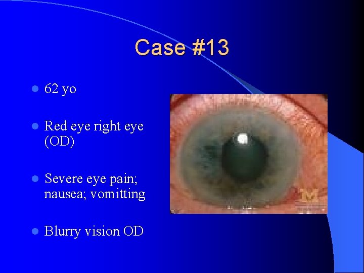 Case #13 l 62 yo l Red eye right eye (OD) l Severe eye