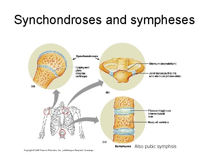 Synchondroses and sympheses Also pubic symphsis 