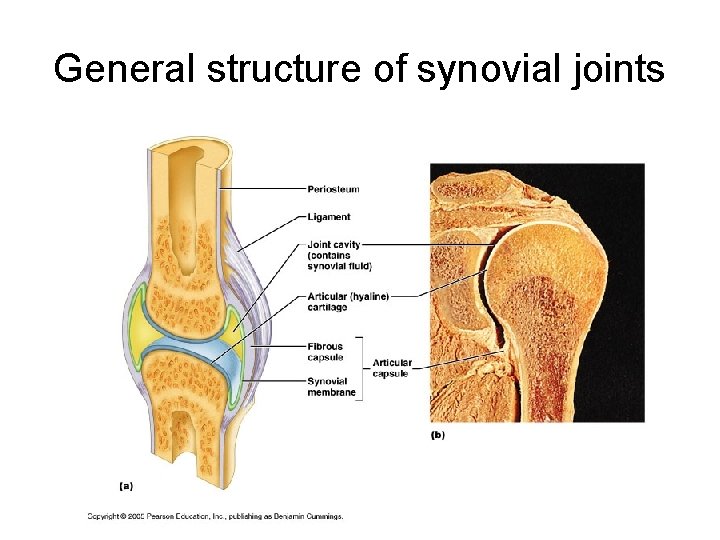 General structure of synovial joints 