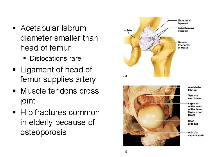 § Acetabular labrum diameter smaller than head of femur § Dislocations rare § Ligament