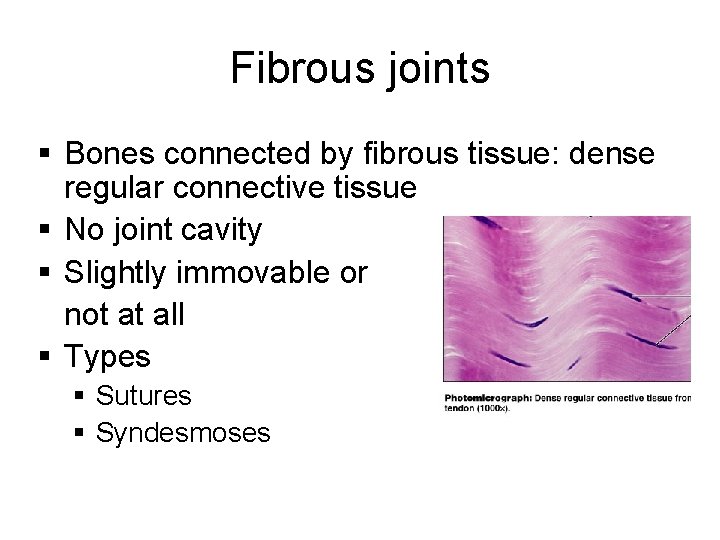 Fibrous joints § Bones connected by fibrous tissue: dense regular connective tissue § No