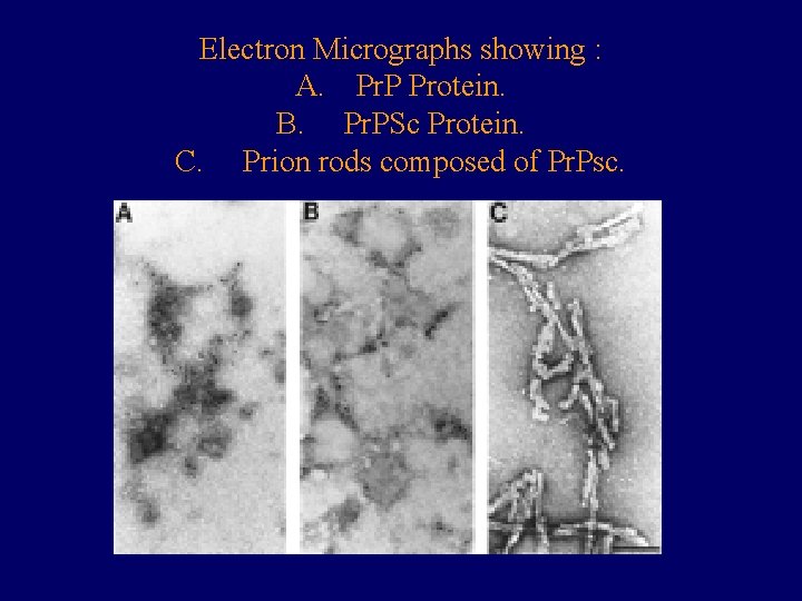 Electron Micrographs showing : A. Pr. P Protein. B. Pr. PSc Protein. C. Prion
