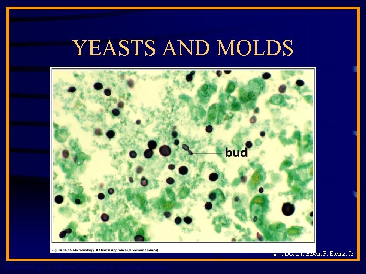 YEASTS AND MOLDS © CDC/ Dr. Edwin P. Ewing, Jr. Microbiology: A Clinical Approach