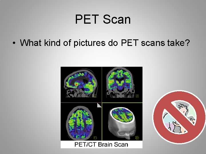 PET Scan • What kind of pictures do PET scans take? 